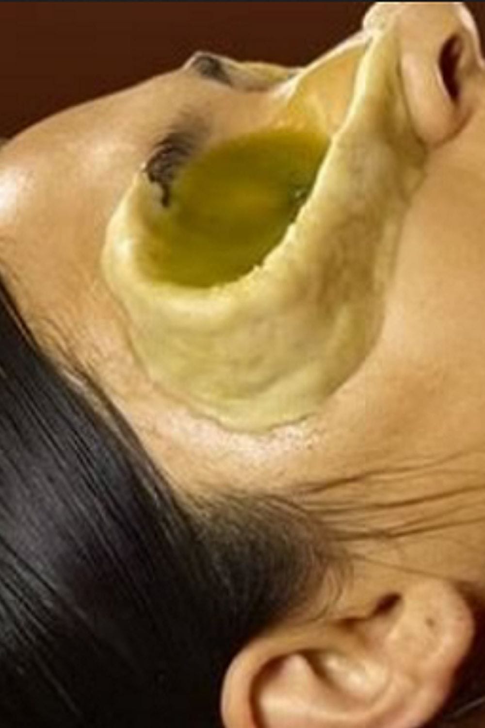 Netra Pindi Ayurveda Therapy